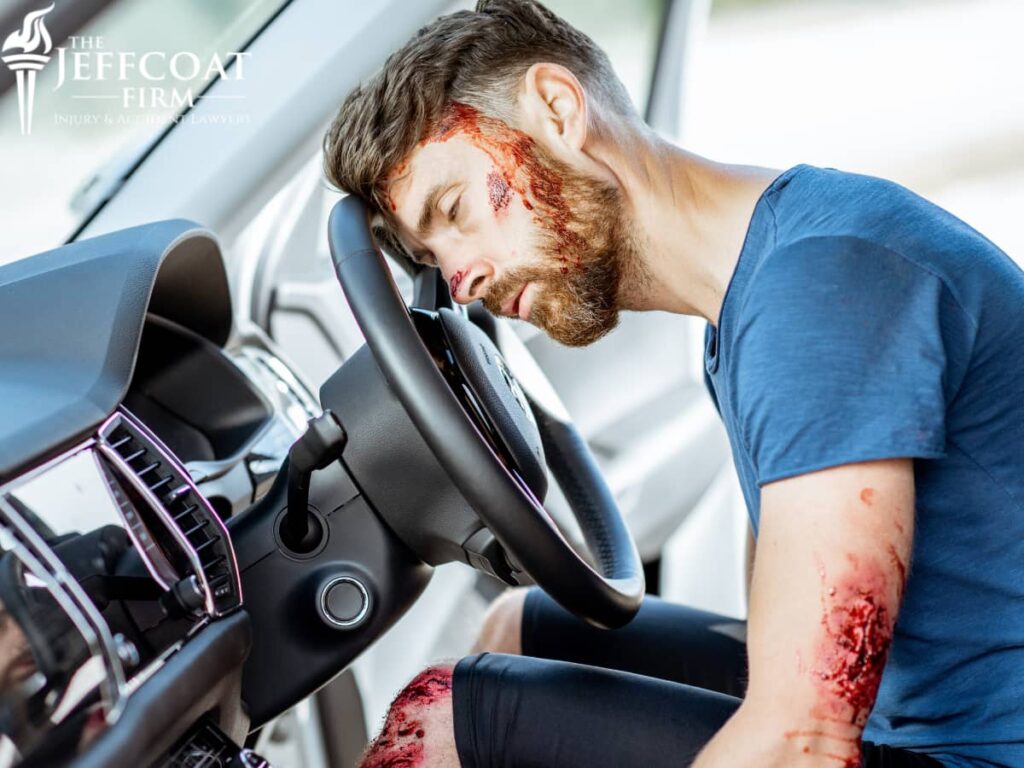 Car Accident Face Injuries